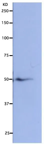 WB analysis of HeLa whole cell lysate using GTX00733 NUF2 antibody.<br>Dilution : 1:5000