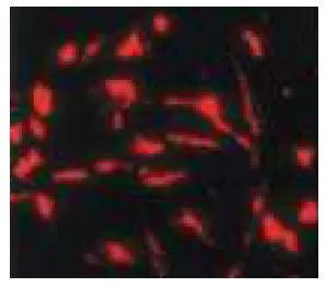 ICC/IF analysis of mouse neuroepithelial cells using GTX00737 Nestin antibody. Dilution : 1:300