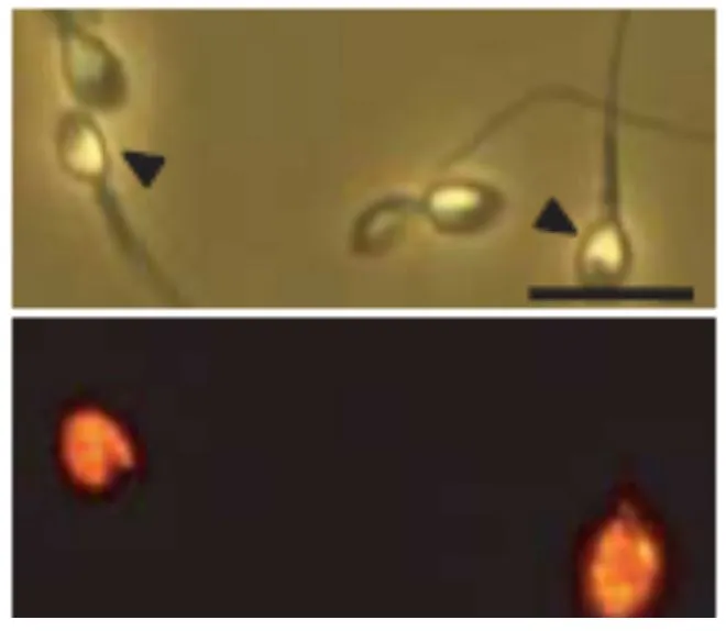 ICC/IF analysis of human sperms using GTX00746 IZUMO1 antibody. Lower : Primary antibody Dilution : 1:100 ICC/IF analysis of human sperms using GTX00746 IZUMO1 antibody. Lower : Primary antibody Dilution : 1:100