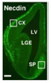 IHC-Fr analysis of mouse forebrain tissue section (E13.5) using GTX00751 Necdin antibody. CX : Cortex LV : Lateral Ventricle LGE : Lateral Ganglionic Eminence SP : Septum Dilution : 1:500 IHC-Fr analysis of mouse forebrain tissue section (E13.5) using GTX00751 Necdin antibody. CX : Cortex LV : Lateral Ventricle LGE : Lateral Ganglionic Eminence SP : Septum Dilution : 1:500