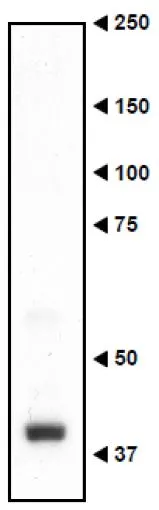 WB analysis of mouse embryo (E16.5) using GTX00751 Necdin antibody. The larger size reported here and elsewhere may reflect post-translational modifications such as ubiquitination and phosphorylation at several sites. Dilution : 1:3000 Loading : 20 microg
