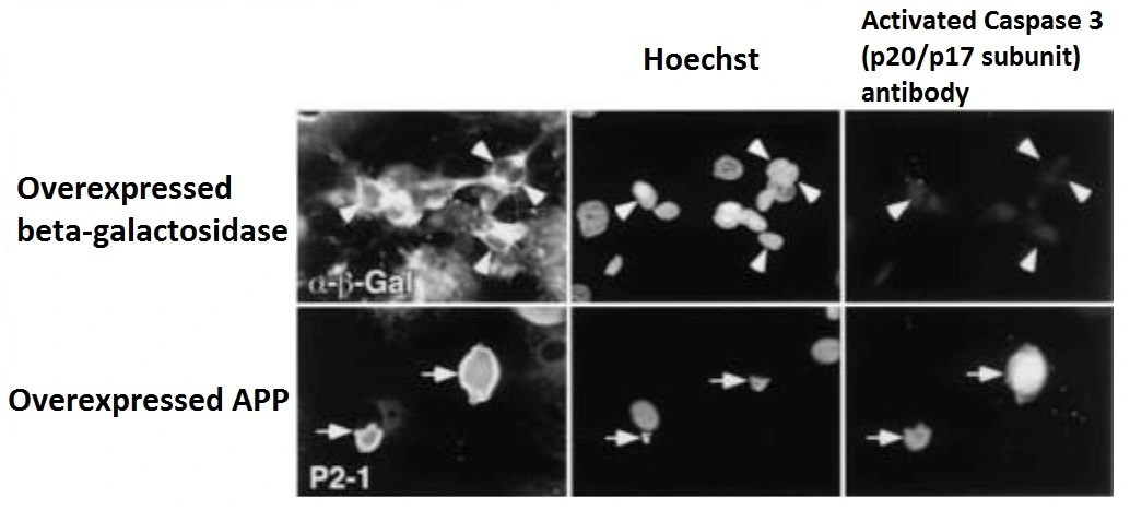 ICC/IF analysis of NT2 neurons using GTX00752 Caspase 3 antibody. Triply stained for the N-terminus of APP (with P2-1) or beta-gal (with anti- beta gal antibody), chromosomal DNA (Hoechst), and activated caspase 3 subunits (with GTX00752). Some neurons accumulating APP are strongly immunostained with GTX00752 (arrows), whereas neurons accumulating beta-gal are hardly labeled (arrowheads). Fixation : 4% PFA ICC/IF analysis of NT2 neurons using GTX00752 Caspase 3 antibody. Triply stained for the N-terminus of APP (with P2-1) or beta-gal (with anti- beta gal antibody), chromosomal DNA (Hoechst), and activated caspase 3 subunits (with GTX00752). Some neurons accumulating APP are strongly immunostained with GTX00752 (arrows), whereas neurons accumulating beta-gal are hardly labeled (arrowheads). Fixation : 4% PFA