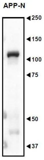 WB analysis of mouse embryo (E16.5) using GTX00753 APP antibody. APP undergoes various post-translational modification such as N- and O-glycosylation, proteolytic cleavage and phosphorylation. Dilution : 1:500 Loading : 10 microg