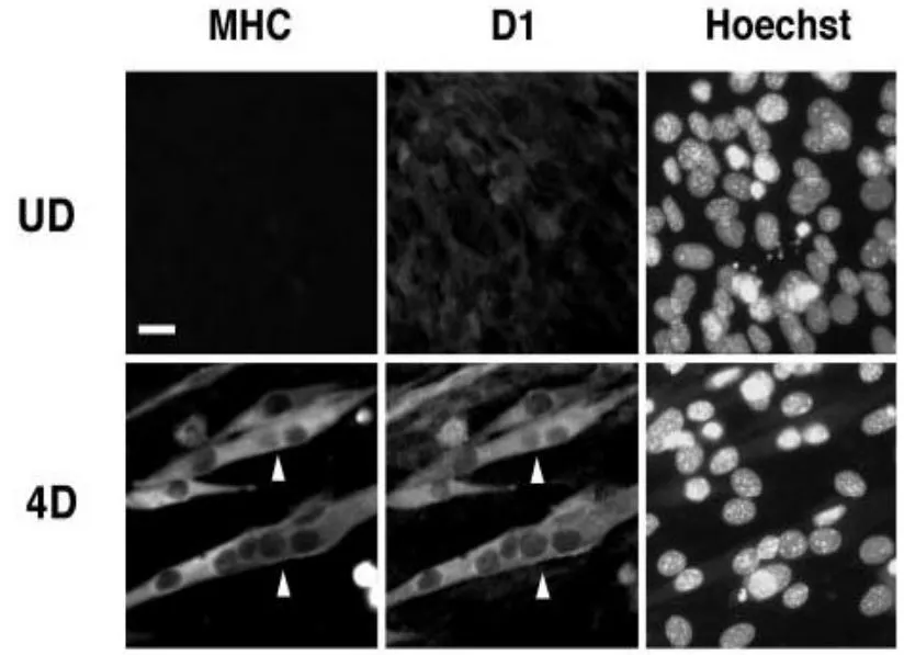 ICC/IF analysis of C2C12 cells using GTX00754 MAGED1 antibody (D1) or MHC antibody (MHC). C2C12 myoblast cells were cultured under undifferentiated conditions (UD) or under differentiation conditions for 4 days (4D). The arrowheads point to differentiated multinucleated myocytes. MHC and MAGE-D1 were distributed predominantly in the cytosol of multinucleated differentiated C2C12 cells. ICC/IF analysis of C2C12 cells using GTX00754 MAGED1 antibody (D1) or MHC antibody (MHC). C2C12 myoblast cells were cultured under undifferentiated conditions (UD) or under differentiation conditions for 4 days (4D). The arrowheads point to differentiated multinucleated myocytes. MHC and MAGE-D1 were distributed predominantly in the cytosol of multinucleated differentiated C2C12 cells.