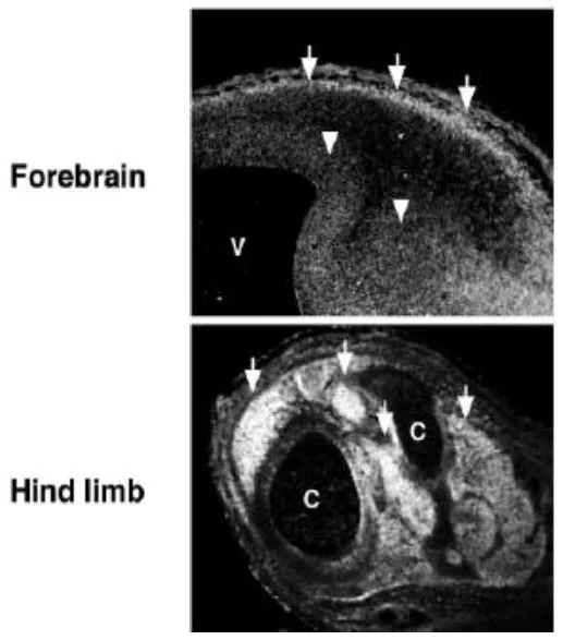 IHC-Fr analysis of mouse embryos using GTX00754 MAGED1 antibody. The arrowheads indicate the ventricular proliferative zone; V : Ventricle; C : Bone Cavity. MAGE-D1 was concentrated in the preplate of the forebrain at E12.5 and skeletal muscle tissues in the hind limb at E14.5. In developing neural tube, MAGE-D1 immunoreactivity was distributed in the ventricular zone as well as the marginal zone. Upper : E12.5 Lower : E14.5 Dilution : 1:300
