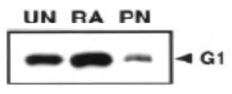 WB analysis of P19 cells at different stages of neural differentiation using GTX00755 MAGEG1 antibody. The result revealed that P19 cells express MAGE-G1 (32 kDa) during the course of neuronal differentiation. The level of MAGE-G1 was the highest in retinoic acid-treated P19 cells. UN : Undifferentiated P19 cells RA : Aggregated cells treated with retinoic acid PN : Enriched postmitotic neurons