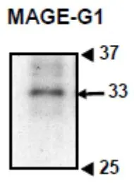 WB analysis of mouse embryonic fibroblast (E14.5) using GTX00755 MAGEG1 antibody. Dilution : 1:300 Loading : 10 microg