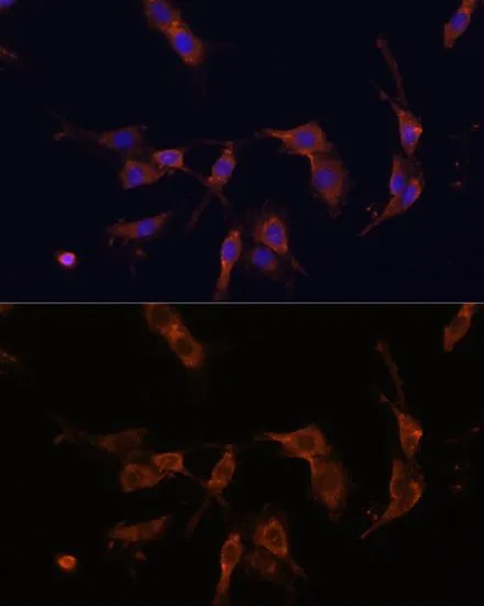 ICC/IF analysis of C6 cells using GTX00764 IQGAP1 antibody. Blue : DAPI Dilution : 1:100