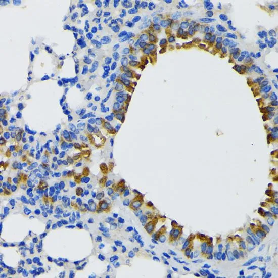 IHC-P analysis of mouse lung tissue using GTX00764 IQGAP1 antibody. Dilution : 1:200