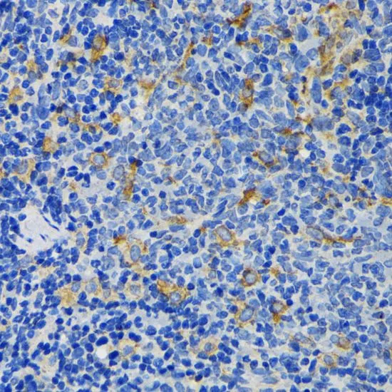 IHC-P analysis of rat spleen tissue using GTX00764 IQGAP1 antibody. Dilution : 1:200