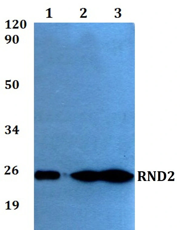 WB analysis of various samples using GTX00770 Rho 7 antibody. Lane 1 : HEK293T whole cell lysate Lane2 : sp2/0 whole cell lysate Lane3 : PC12 whole cell lysate Dilution : 1:500 WB analysis of various samples using GTX00770 Rho 7 antibody. Lane 1 : HEK293T whole cell lysate Lane2 : sp2/0 whole cell lysate Lane3 : PC12 whole cell lysate Dilution : 1:500
