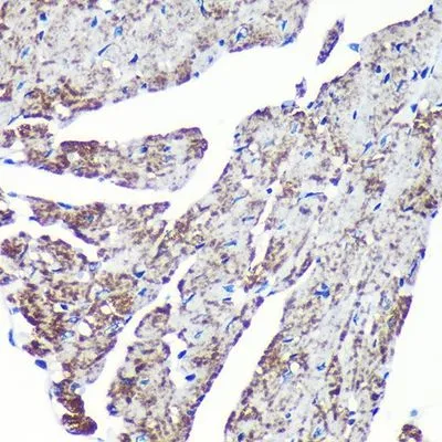 IHC-P analysis of mouse heart tissue section using GTX00773 TOMM20 antibody [GT1136]. Dlution : 1:200