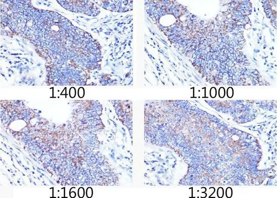 IHC-P analysis of hmuan colon carcinoma tissue section using GTX00773 TOMM20 antibody [GT1136]. Dlution : 1:400-1:3200