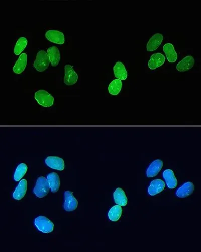 ICC/IF analysis of U2OS cells using GTX00774 Lamin A + C antibody [GT1137]. Green: Primary antibody Blue: DAPI Dlution : 1:200