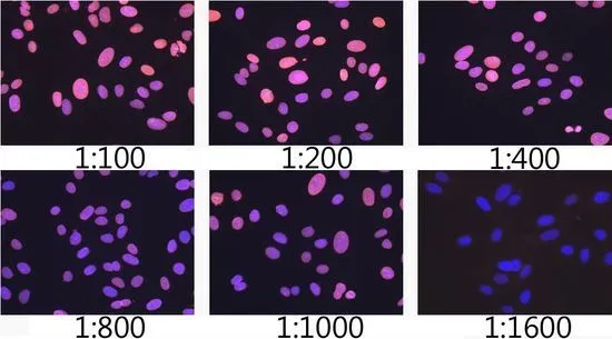 ICC/IF analysis of U2OS cells using GTX00774 Lamin A + C antibody [GT1137]. Pink: Primary antibody Blue: DAPI Dlution : 1:100-1:1600
