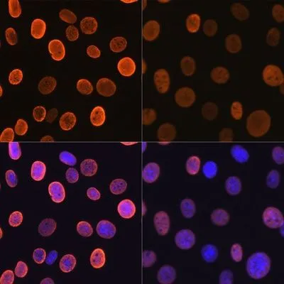 ICC/IF analysis of NIH3T3 cells treated with/without TSA (1 microM at 37oC for 18 hours) using GTX00775 Histone H4K5ac (acetyl Lys5) antibody [GT1138]. Orange: Primary antibody Blue: DAPI