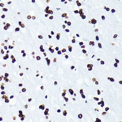 IHC-P analysis of rat brain tissue section using GTX00775 Histone H4K5ac (acetyl Lys5) antibody [GT1138]. Dlution : 1:100