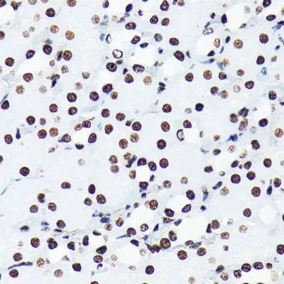 IHC-P analysis of mouse kidney tissue section using GTX00775 Histone H4K5ac (acetyl Lys5) antibody [GT1138]. Dlution : 1:100