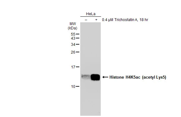 Untreated (-) and treated (+) HeLa whole cell extracts (30 microg) were separated by 15% SDS-PAGE, and the membrane was blotted with Histone H4K5ac (acetyl Lys5) antibody [GT1138] (GTX00775) diluted at 1:500. The HRP-conjugated anti-rabbit IgG antibody (GTX213110-01) was used to detect the primary antibody.