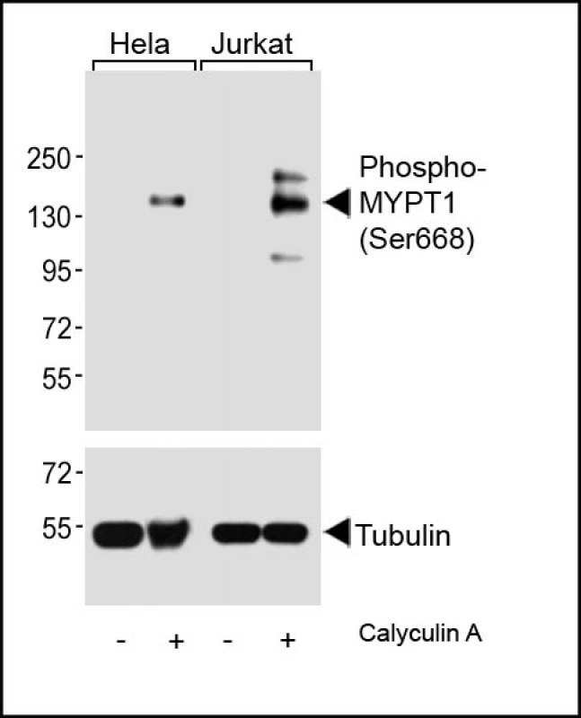 WB analysis of HeLa and Jurkat untrated or treated with Calyculin A (100nM) cell lysate using GTX00776 MYPT1 (phospho Ser668) antibody. WB analysis of HeLa and Jurkat untrated or treated with Calyculin A (100nM) cell lysate using GTX00776 MYPT1 (phospho Ser668) antibody.