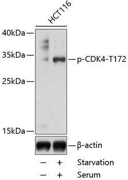 WB analysis of HCT116 cells treated by 10% FBS (8 hrs after serum-starvation overnight) using GTX00778 CDK4 (phospho Thr172) antibody.<br>Dilution : 1:1000<br>Loading : 25?g per lane