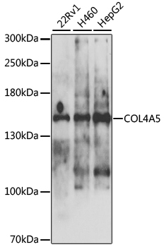 WB analysis of various cell lysates using GTX00784 COL4A5 antibody.<br>Dilution : 1:1000<br>Loading : 25?g