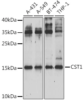 WB analysis of various sample lysates using GTX00786 Cystatin SN antibody. Dilution : 1:1000 Loading : 25microg per lane WB analysis of various sample lysates using GTX00786 Cystatin SN antibody. Dilution : 1:1000 Loading : 25microg per lane
