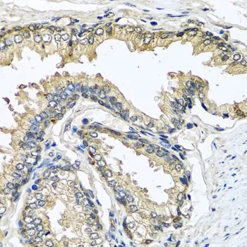 IHC-P analysis of rat brain tissue using GTX00786 Cystatin SN antibody. Dilution : 1:100
