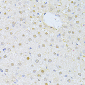 IHC-P analysis of rat liver tissue using GTX00787 FBXO32 antibody. <br>Dilution : 1:100