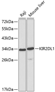 WB analysis of various sample lysates using GTX00788 KIR2DL1 antibody.<br>Dilution : 1:1000<br>Loading : 25?g