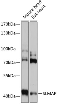 WB analysis of various sample lysates using GTX00790 SLMAP antibody.<br> Dilution : 1:3000<br>Loading : 25?g