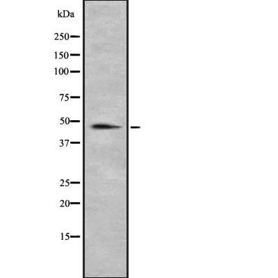WB analysis of HUVEC cell lysates using GTX00791 RBMS3 antibody.