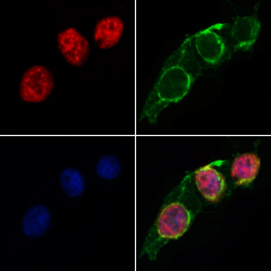 ICC/IF analysis of PFA-fixed HeLa cells using GTX00792 RUNX2 antibody. Red : Primary antibody Green : Tubulin Permeabilization : 0.1% Triton X-100 Dilution : 1:200 ICC/IF analysis of PFA-fixed HeLa cells using GTX00792 RUNX2 antibody. Red : Primary antibody Green : Tubulin Permeabilization : 0.1% Triton X-100 Dilution : 1:200