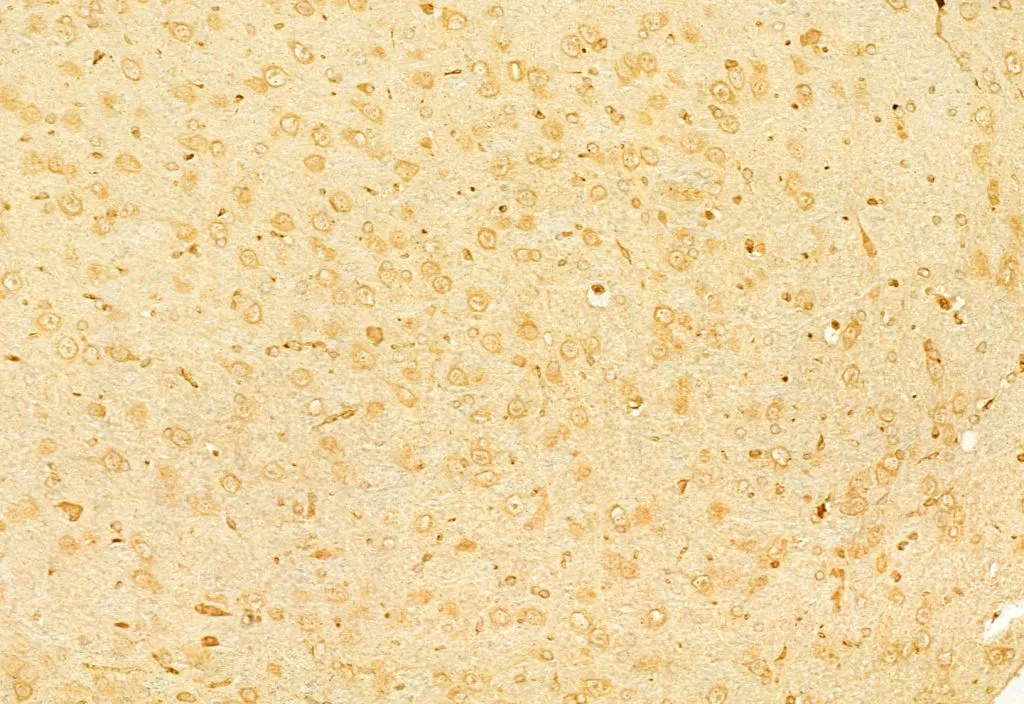IHC-P analysis of mouse brain tissue using GTX00792 RUNX2 antibody. Antigen retrieval : Heat mediated antigen retrieval step in citrate buffer Dilution : 1:100