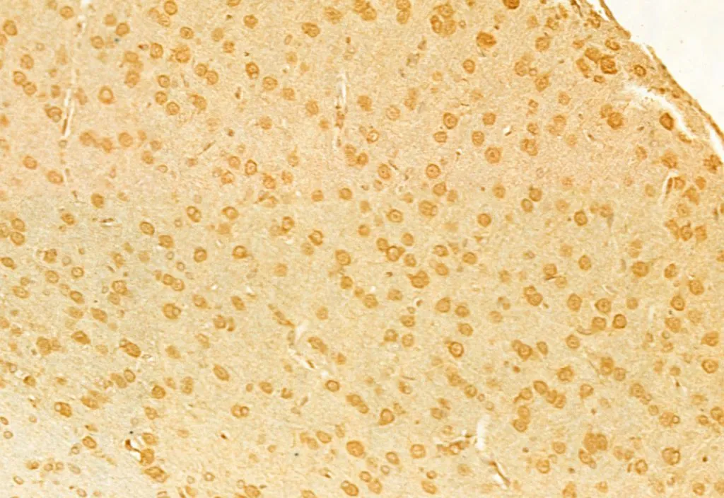 IHC-P analysis of rat brain tissue using GTX00792 RUNX2 antibody. Antigen retrieval : Heat mediated antigen retrieval step in citrate buffer Dilution : 1:100