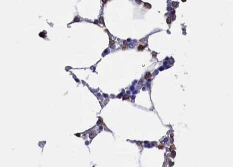 IHC-P analysis of human bone marrow tissue using GTX00792 RUNX2 antibody. Antigen retrieval : Heat mediated antigen retrieval step in citrate buffer Dilution : 1:100