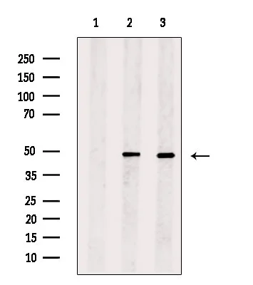 WB analysis of various cell lysates using GTX00792 RUNX2 antibody. Lane 1 : HeLa cell lysate, blocked with antigen-specific peptides Lane 2 : HeLa cell lysate Lane 3 : MCF7 cell lysate