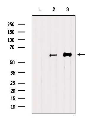 WB analysis of various tissue lysates using GTX00792 RUNX2 antibody. Lane 1 : Mouse brain tissue lysate treated with blocking peptide Lane 2 : Mouse brain tissue lysate Lane 3 : Rat spleen tissue lysate
