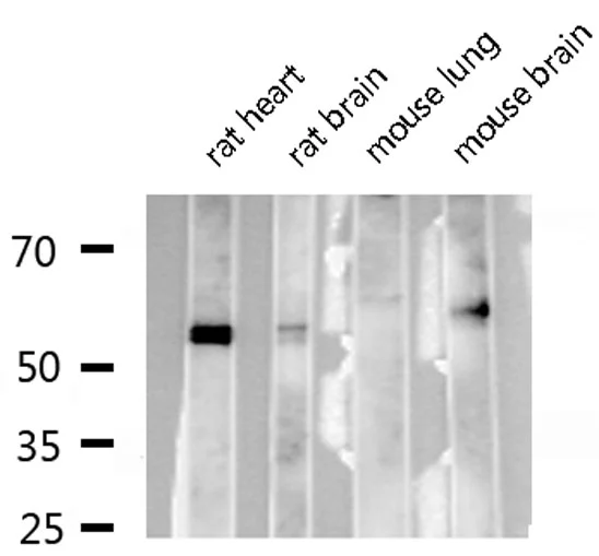WB analysis of various tissue lysates using GTX00792 RUNX2 antibody. Lane 1 : Rat heart tissue lysate Lane 2 : Rat brain tissue lysate Lane 3 : Mouse lung tissue lysate Lane 4 : Mouse brain tissue lysate