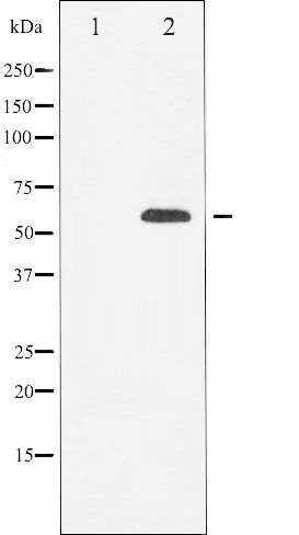 WB analysis of HeLa cell lysate using GTX00792 RUNX2 antibody. The lane on the left was treated with the antigen-specific peptide.