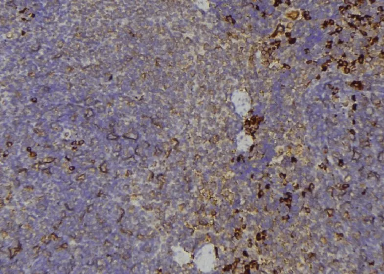 IHC-P analysis of human lymph node tissue using GTX00794 TIE2 (phospho Tyr992) antibody. Antigen retrieval : Heat mediated antigen retrieval step in citrate buffer Dilution : 1:100