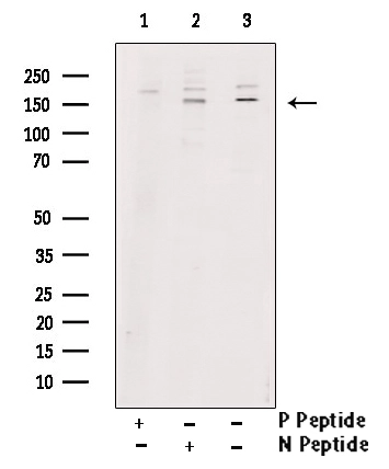 WB analysis of 293 cells transfected with wild-type Tie2 using GTX00794 TIE2 (phospho Tyr992) antibody pre-incubated with phospho- or non-phospho- peptide.<br>P-peptide : phospho-peptide<br>N-peptide : non-phospho-peptide