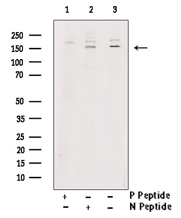 WB analysis of 293 cells transfected with wild-type Tie2 using GTX00794 TIE2 (phospho Tyr992) antibody pre-incubated with phospho- or non-phospho- peptide. P-peptide : phospho-peptide N-peptide : non-phospho-peptide