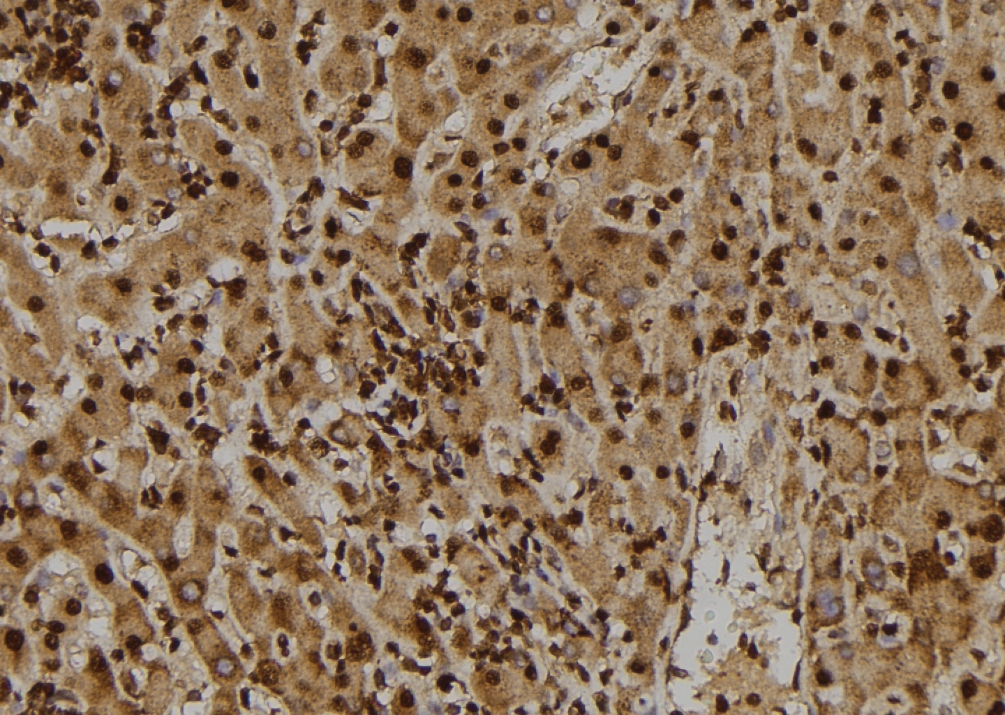 IHC-P analysis of human liver tissue using GTX00795 TIE2 (phospho Tyr897) antibody. Antigen retrieval : Heat mediated antigen retrieval step in citrate buffer Dilution : 1:100