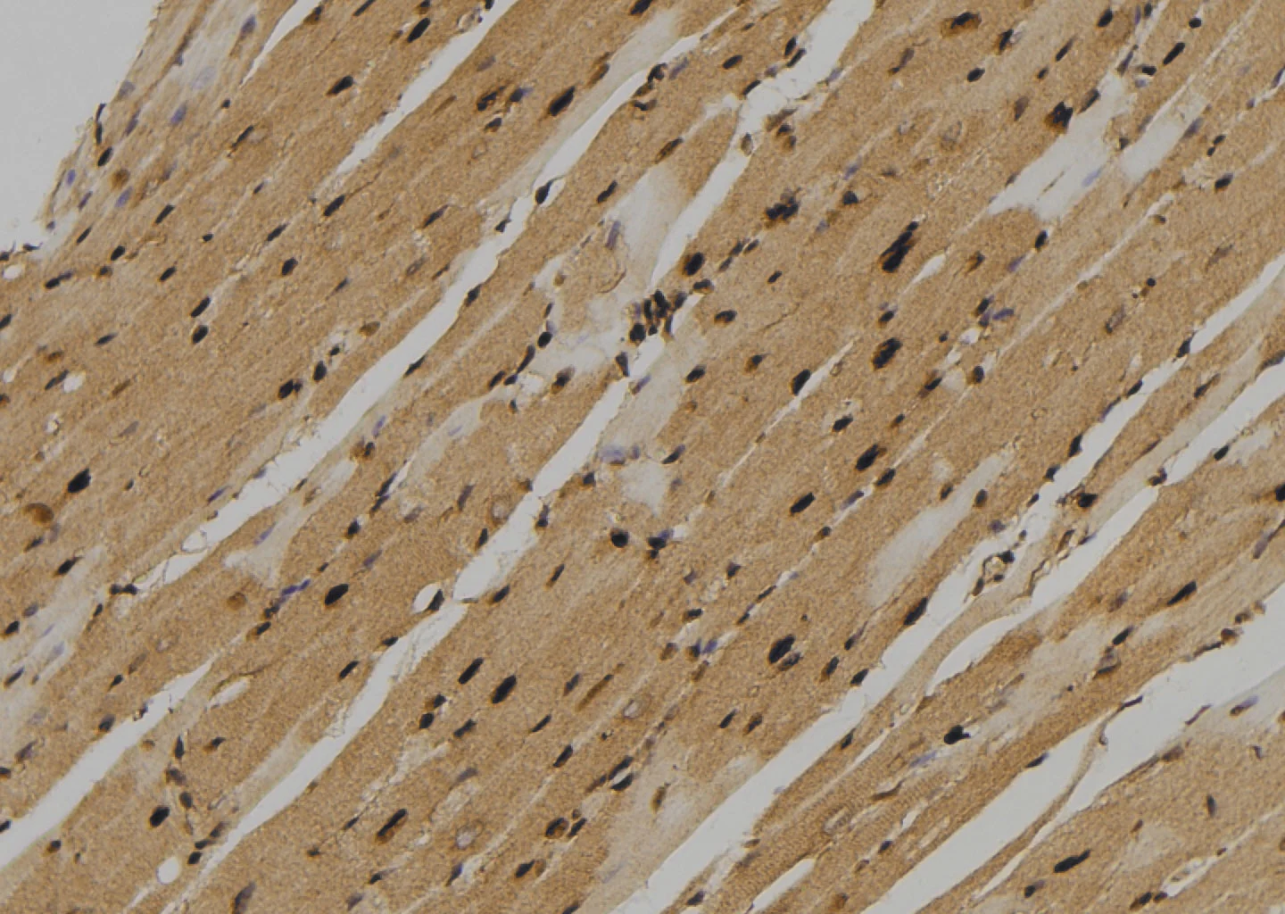 IHC-P analysis of mouse heart tissue using GTX00795 TIE2 (phospho Tyr897) antibody. Antigen retrieval : Heat mediated antigen retrieval step in citrate buffer Dilution : 1:100