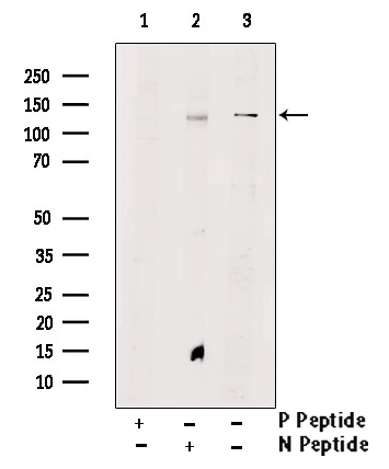 WB analysis of NIH-3T3 cell lysates using GTX00795 TIE2 (phospho Tyr897) antibody pre-incubated with phospho- or non-phospho- peptide.<br>P-peptide : phospho-peptide<br>N-peptide : non-phospho-peptide