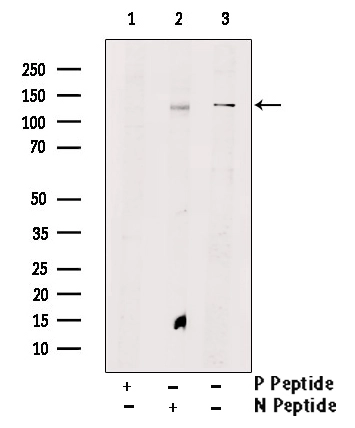 WB analysis of NIH-3T3 cell lysates using GTX00795 TIE2 (phospho Tyr897) antibody pre-incubated with phospho- or non-phospho- peptide. P-peptide : phospho-peptide N-peptide : non-phospho-peptide