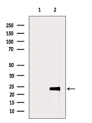 WB analysis of VERO cell lysate using GTX00796 Claudin 5 antibody. The lane on the left was treated with blocking peptide.