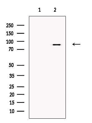 WB analysis of HeLa cell lysate using GTX00800 MARK4 antibody. The lane on the left was treated with blocking peptide.