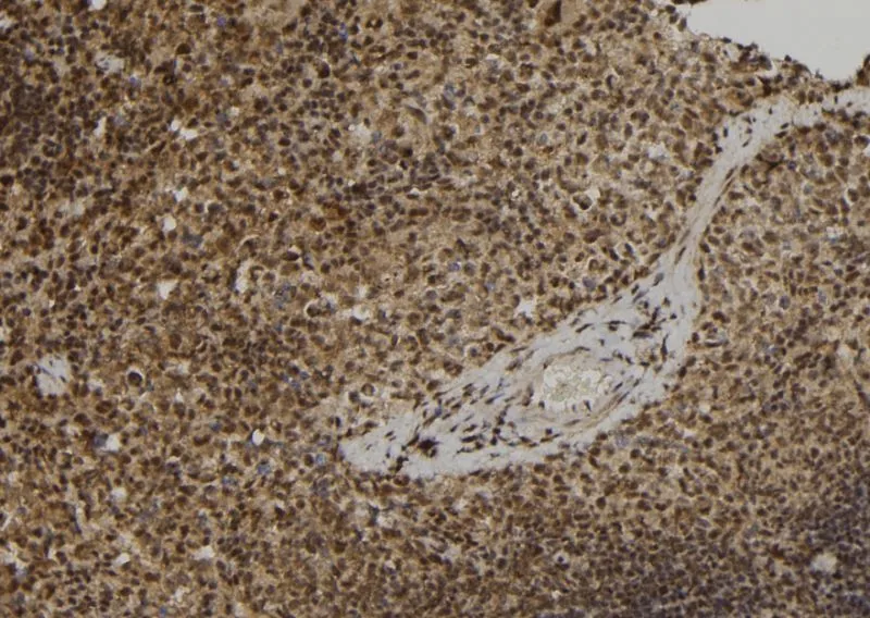 IHC-P analysis of mouse spleen tissue using GTX00801 ELOF1 antibody. Antigen retrieval : Heat mediated antigen retrieval step in citrate buffer Dilution : 1:100 IHC-P analysis of mouse spleen tissue using GTX00801 ELOF1 antibody. Antigen retrieval : Heat mediated antigen retrieval step in citrate buffer Dilution : 1:100